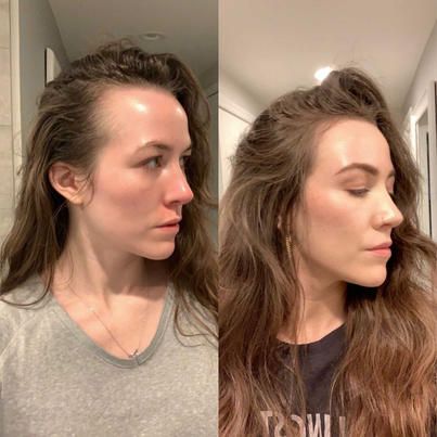 Hair Growth Accelerator - with Lustriva®